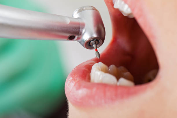 Best Emergency Dentist for Knocked-Out Tooth in Anahuac, TX